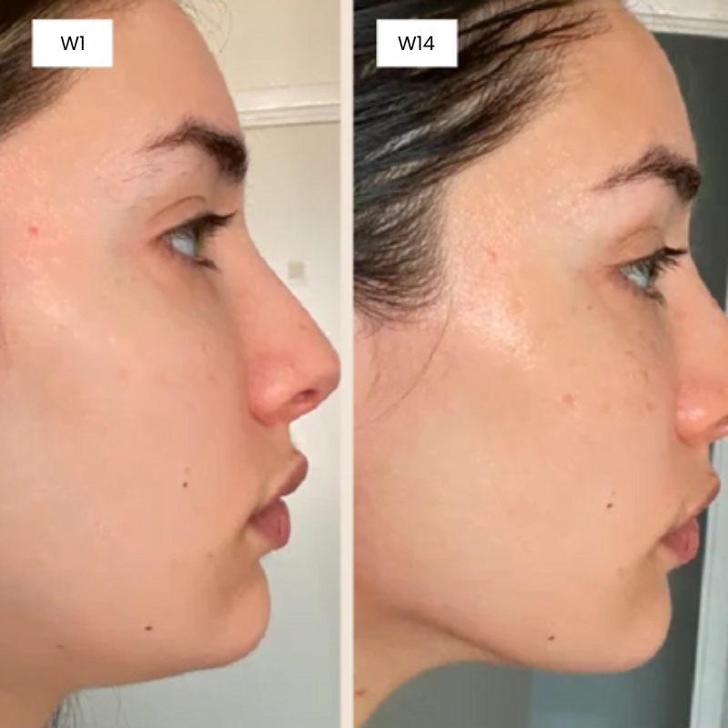 V-Line Fit Mask